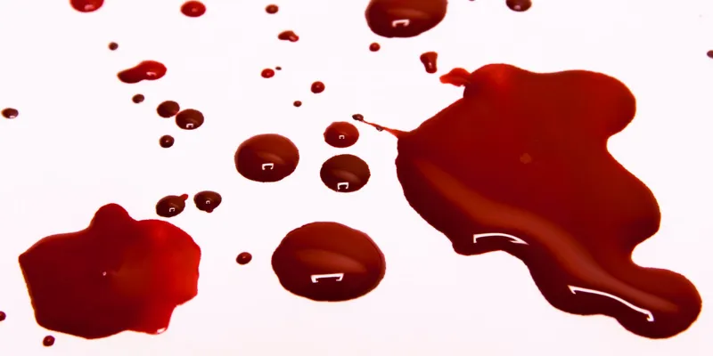 Sự thay đổi hoặc mất mát trong cuộc sống